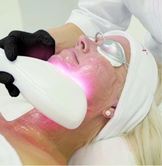 Zafiro Thermolift Procedure